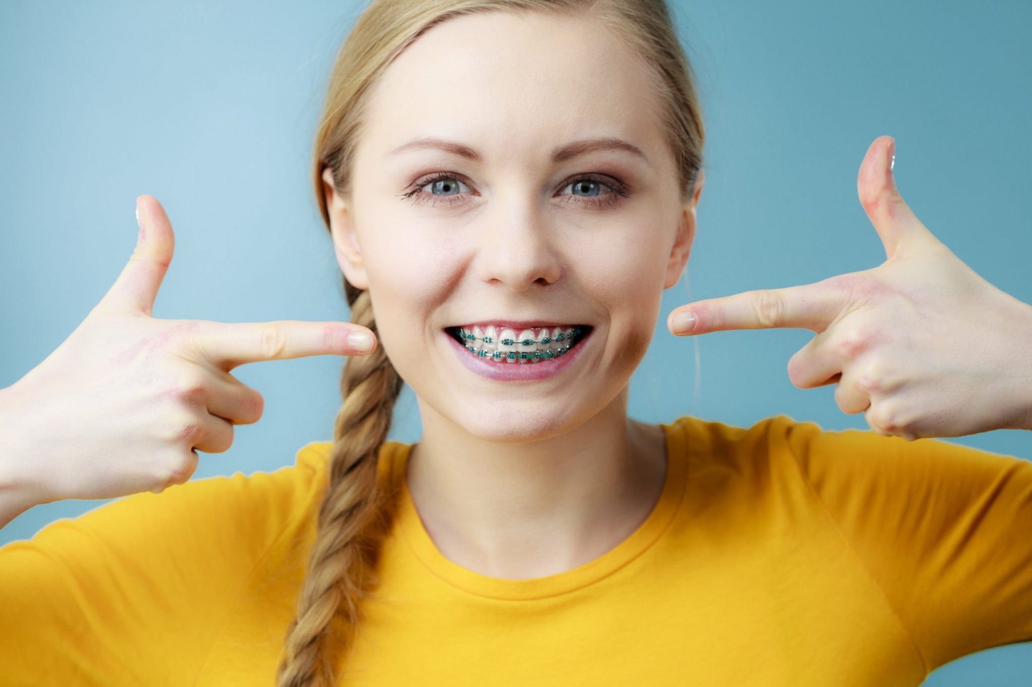 Blue Braces: How To Pick the Right Colors for Your Braces - Blue Ridge  Orthodontics